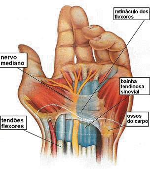 5 Principais Sintomas: como sei que tenho tendinite.