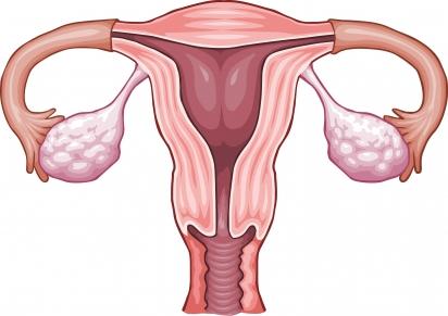 Cancro do colo do útero