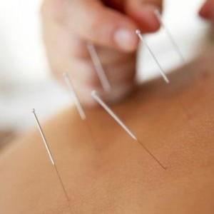 Os princípios da acupunctura