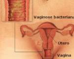 Saúde da Mulher: Saiba tudo sobre Corrimentos Varginal