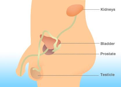 Sintomas de cancro da próstata