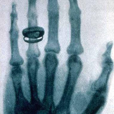 A história da Radiografia